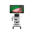 Torre de Laparoscopia 4K modelo UX5 - Marca Mindray
