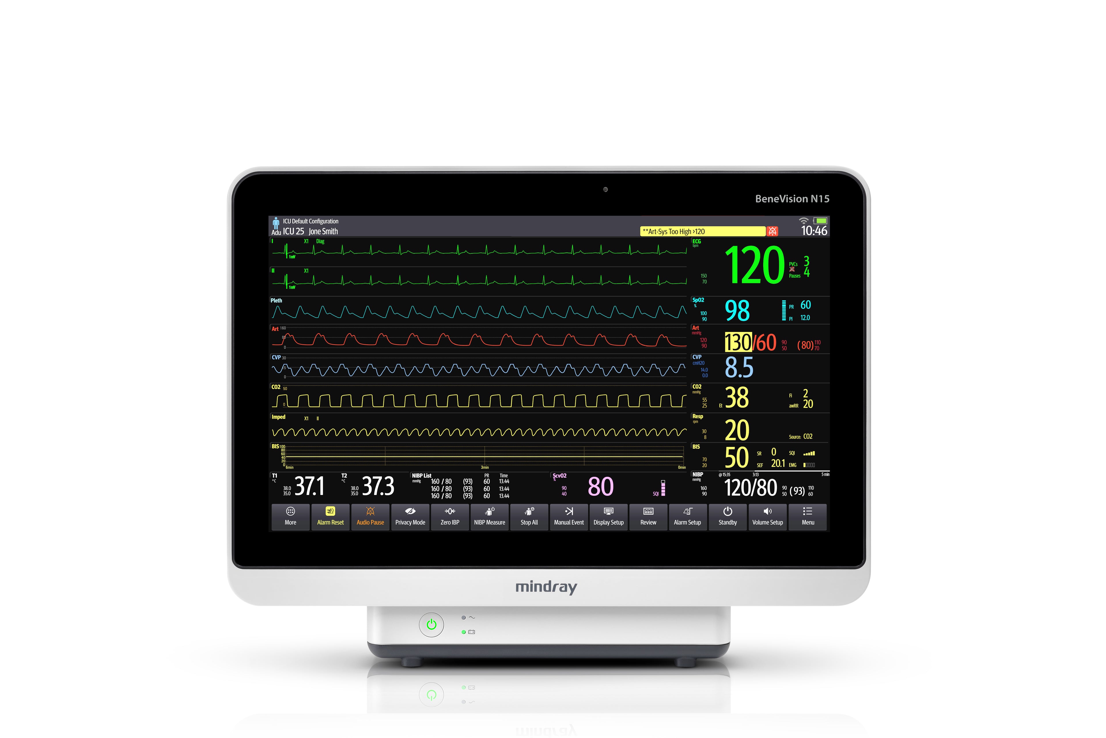 MONITOR DE SIGNOS VITALES (DE TERAPIA INTENSIVA) con módulo multiparamétrico Marca: MINDRAY Modelo: N15